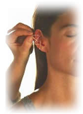 auriculoterapia-1
